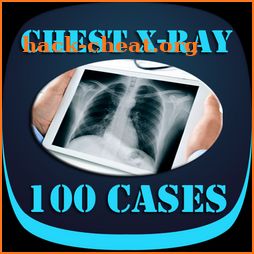 Interpret Chest X-Ray With 100 Cases icon