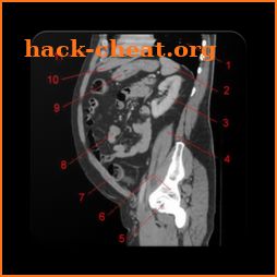 Pocket Atlas of CT ABDOMEN icon