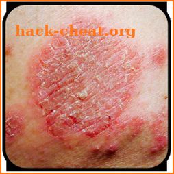 Skin Rash Cure icon