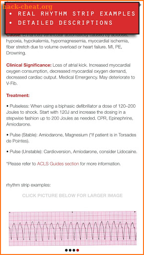 ACLS med screenshot