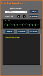 ACLS Rhythm Quiz screenshot