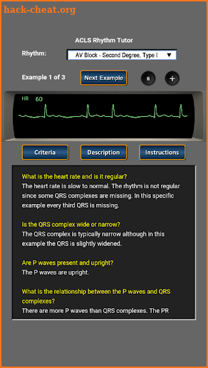 ACLS Rhythm Tutor screenshot