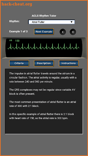 ACLS Rhythm Tutor screenshot