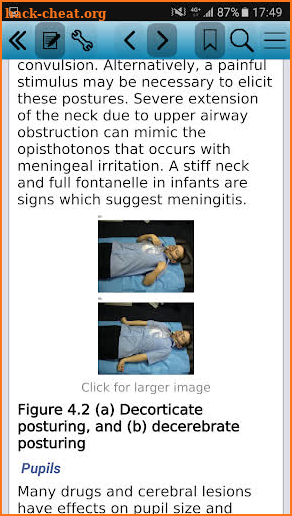 Advanced Paediatric Life Sup 6 screenshot