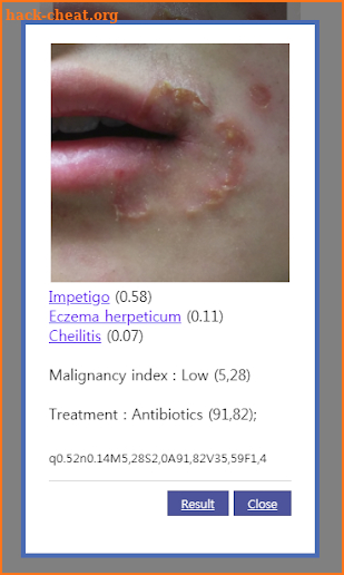 AI Dermatology - Skin Disease Diagnosis screenshot