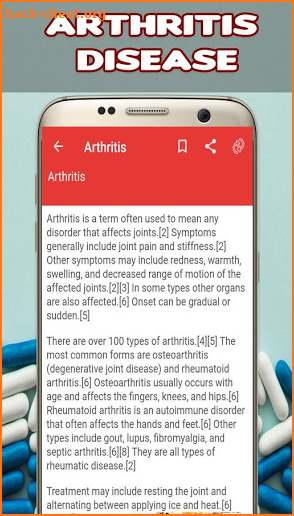 Arthritis: Causes, Diagnosis, and Treatment screenshot