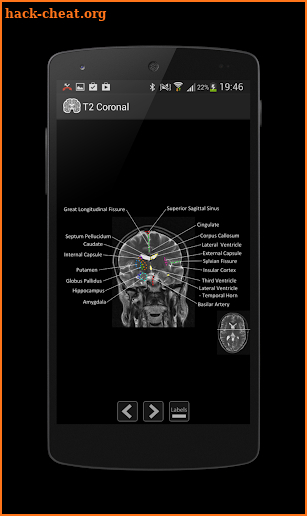 Atlas of MRI Brain Anatomy screenshot