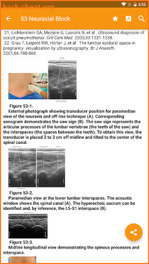 Atlas of Ultrasound Anesthesia screenshot