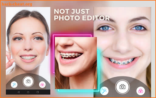 Behel Camera Beauty Brace screenshot