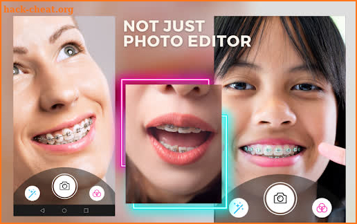 Behel Camera Beauty Brace screenshot