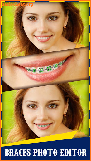 Braces screenshot