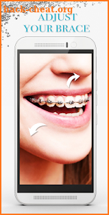 Braces Photo Editor - Braces Filter Colored screenshot