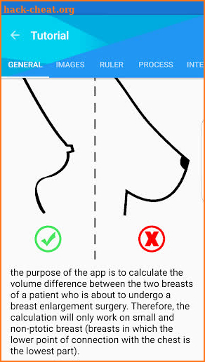 Breast Size Difference screenshot