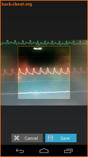 Capstesia App Anesthesia screenshot