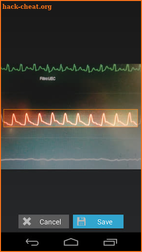 Capstesia App Anesthesia screenshot