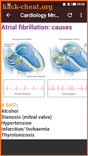 Cardiology Mnemonics screenshot