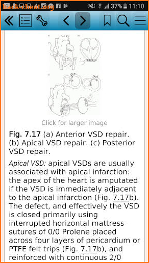 Cardiothoracic Surgery, Second Edition screenshot