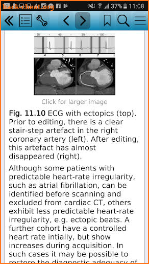 Cardiovascular Computed Tomography screenshot