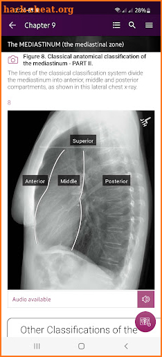 Chest X-Ray Interpretation screenshot