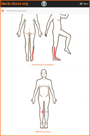 Clinical Pattern Recognition: Knee Pain screenshot