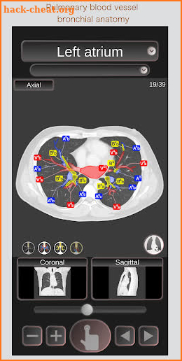 CT Passport Chest / sectional anatomy / MRI screenshot