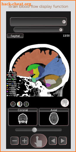 CT Passport Head/Brain / sectional anatomy / MRI screenshot