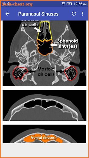 CT Scan Cross Sectional Anatomy screenshot