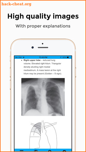 CXR FlashCards screenshot