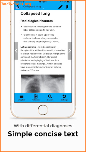 CXR FlashCards screenshot