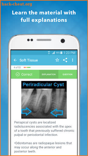 Dental Boards Mastery: NBDE II screenshot