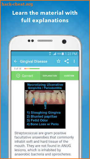 Dental Hygiene Mastery: NBDHE screenshot