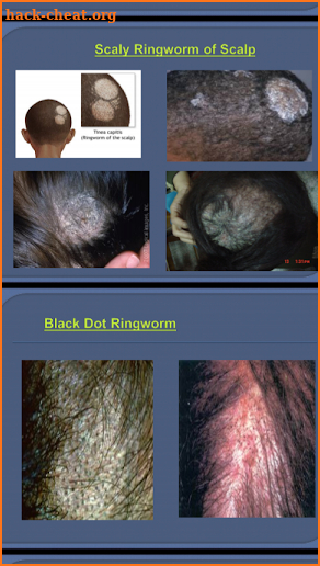 Dermatology Made Easy screenshot