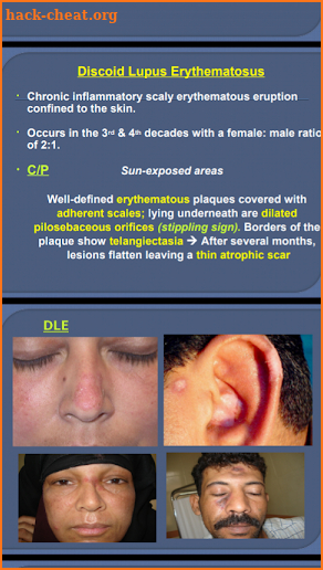 Dermatology Made Easy screenshot