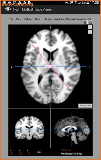 Dicom Medical Image Viewer screenshot