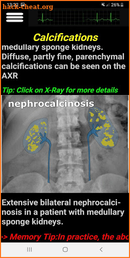 Easy Abdominal X-Ray screenshot