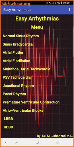 Easy Arrhythmias screenshot