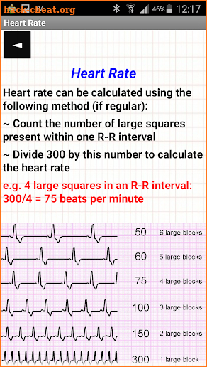 Easy ECG screenshot