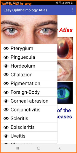 Easy Ophthalmology Atlas screenshot