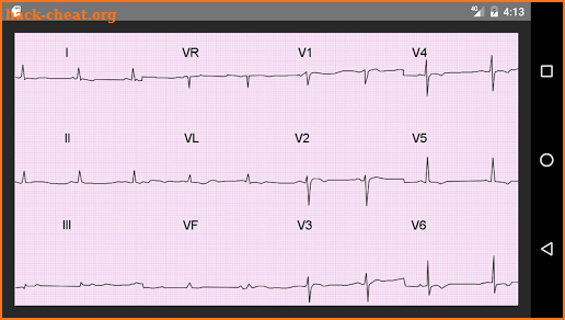 ECG 100 Clinical Cases screenshot