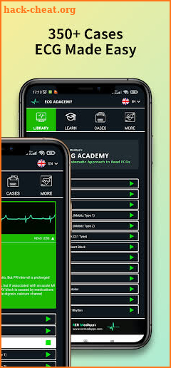 ECG Academy | EKG Cases 2022 screenshot