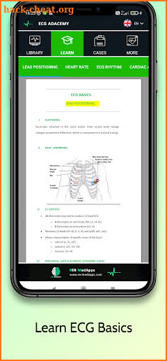 ECG Academy | EKG Cases 2022 screenshot