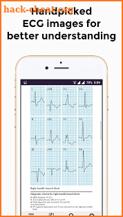 ECG Basics - Full screenshot