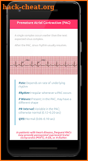 ECG FlashCards screenshot