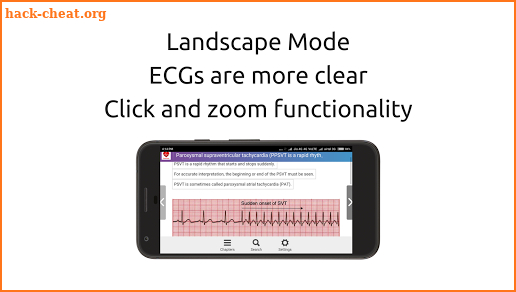 ECG FlashCards - Free screenshot