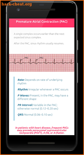 ECG FlashCards - Free screenshot