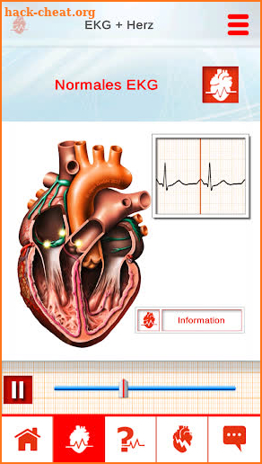 ECG in Motion Subscription-Version screenshot