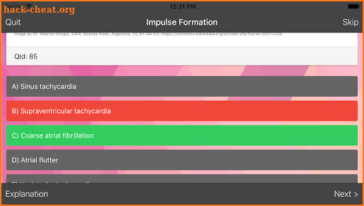 ECG Master: Electrocardiogram Quiz & Practice screenshot