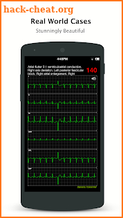 ECG Pro - Cases & Compendiums screenshot