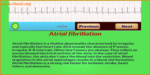 ECG Rhythm screenshot