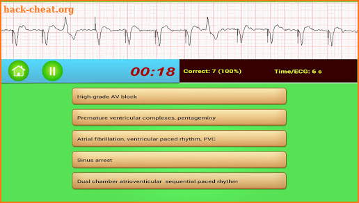 ECG Rhythm screenshot